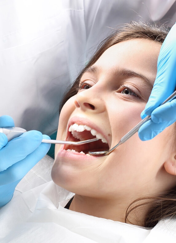 What-Are-Composite-Fillings-Img
