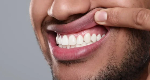 Crack Teeth