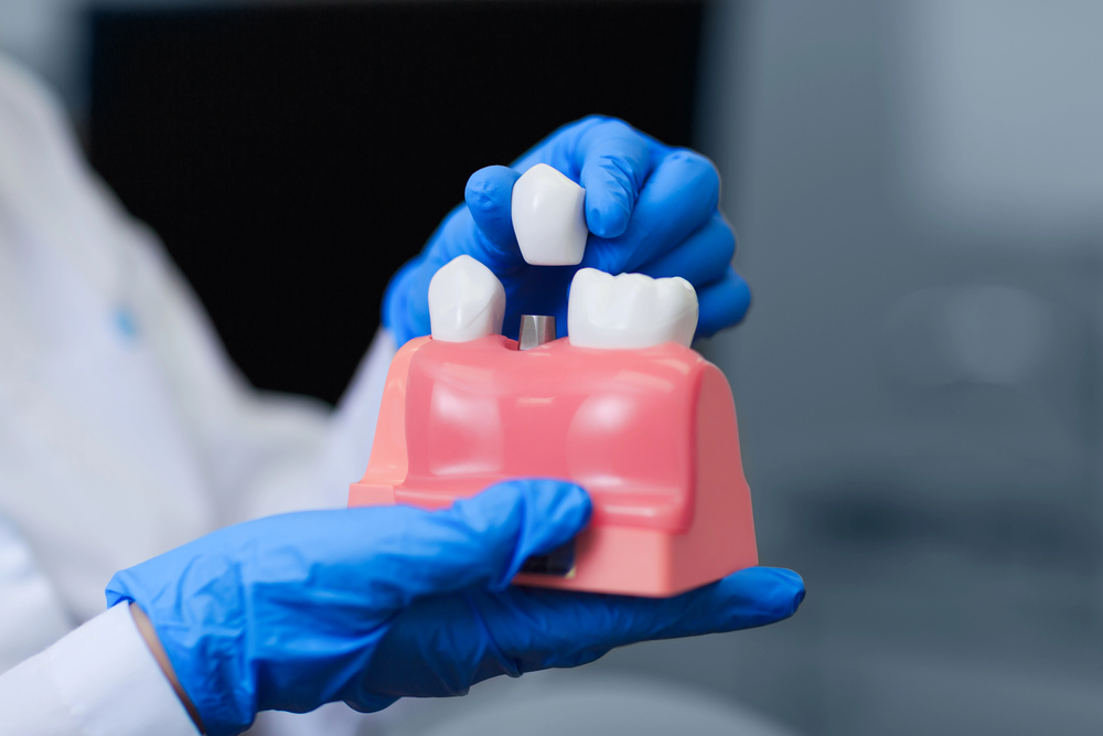 Can You Get Dental Implants With Gum Disease? What You Need To Know