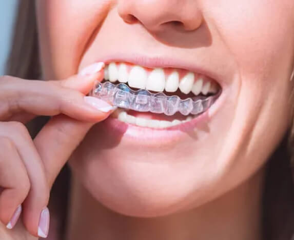 Invisalign