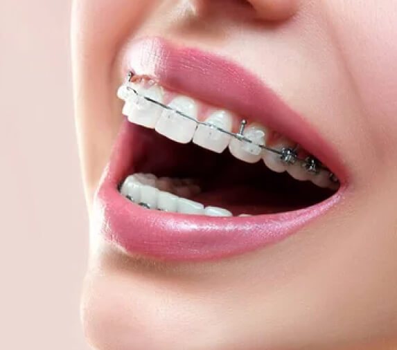 Orthodontics