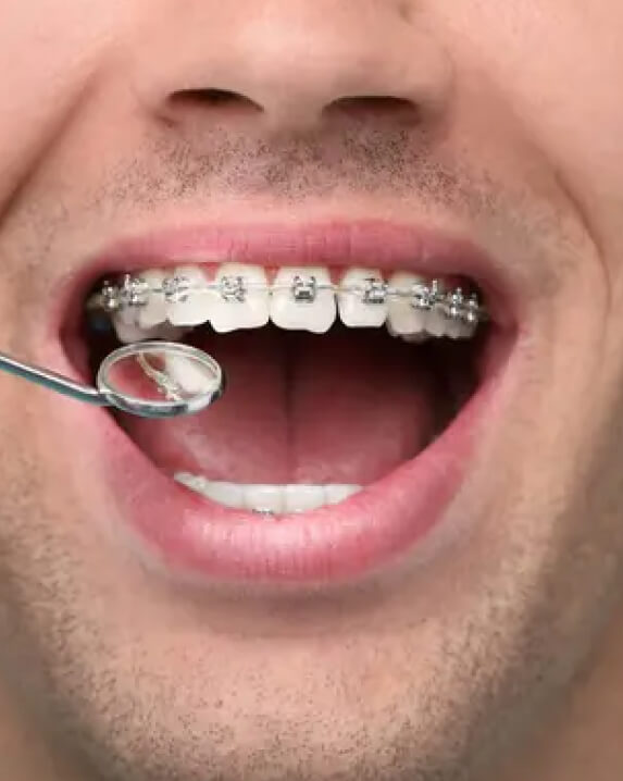 Orthodontics