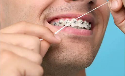 Orthodontics