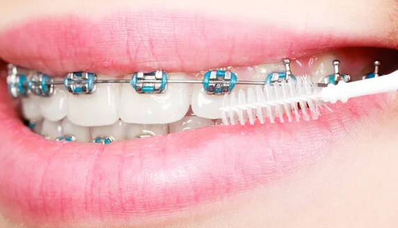 Orthodontics