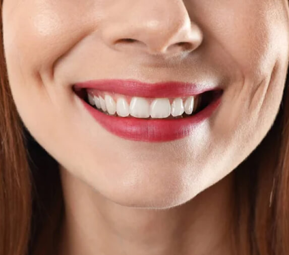Smile Makeovers