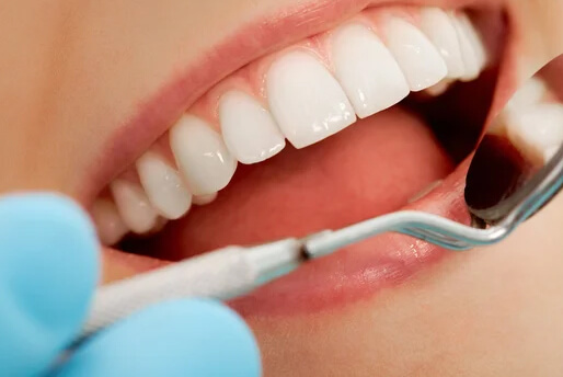 Teeth Whitening