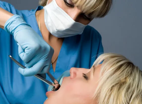 Tooth Extractions